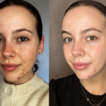 Augustinus Bader The Rich Cream Testing the Best TFC8 Tech for Skin Regeneration