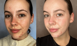 Augustinus Bader The Rich Cream Testing the Best TFC8 Tech for Skin Regeneration