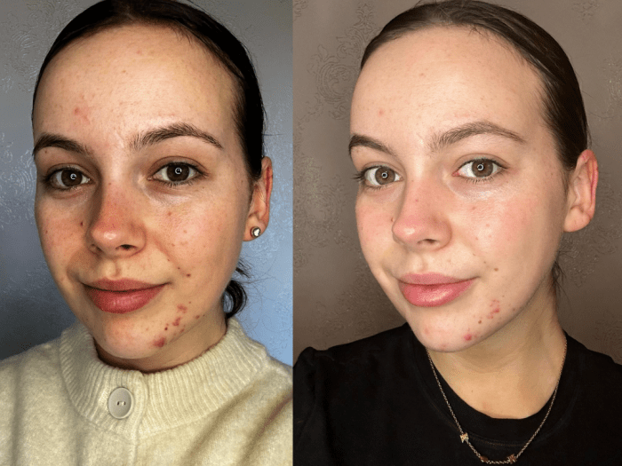 Augustinus Bader The Rich Cream Testing the Best TFC8 Tech for Skin Regeneration